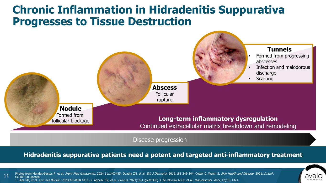 slide11