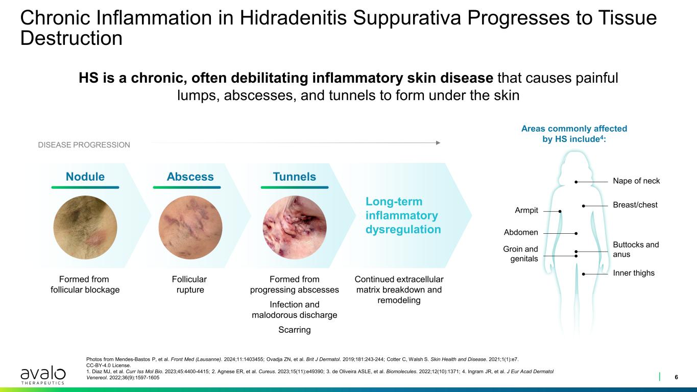 slide6